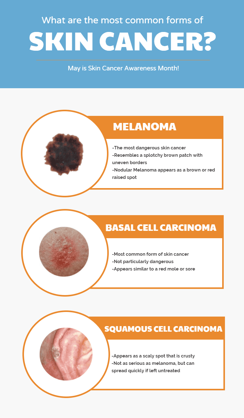 Most Common Type Of Skin Cancer Lance Embry 